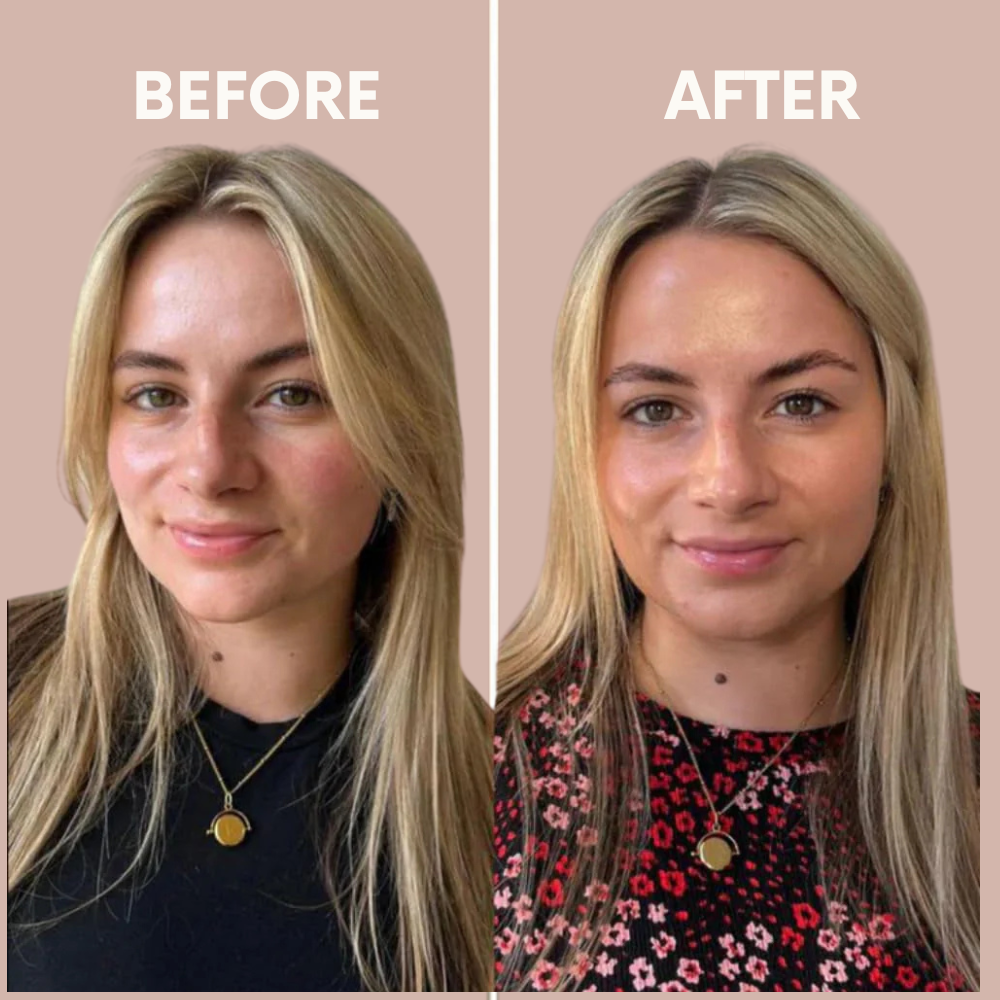 MiIano Drops® — Sunless Tanning Drops